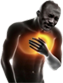 Mjlol chest pain